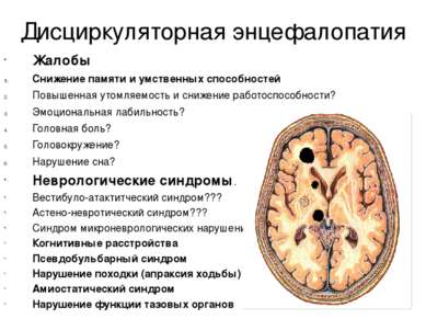 Дисциркуляторная энцефалопатия Жалобы Снижение памяти и умственных способност...