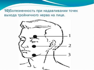 10)Болезненность при надавливании точек выхода тройничного нерва на лице.