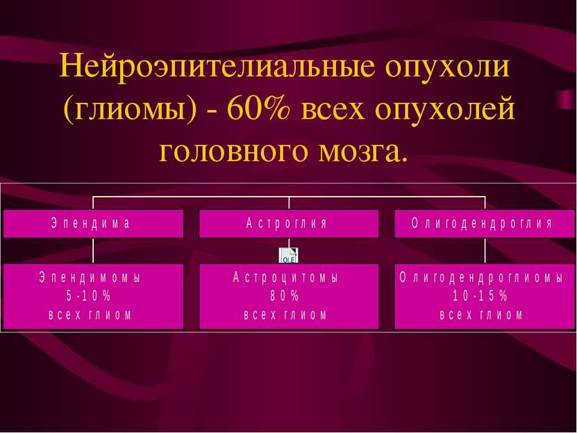 Нейроэпителиальные опухоли (глиомы) - 60% всех опухолей головного мозга.