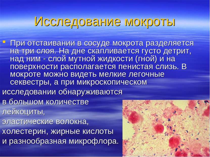 Исследование мокроты При отстаивании в сосуде мокрота разделяется на три слоя...