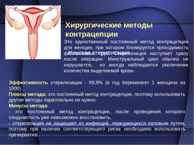 Хирургические методы контрацепции Женская стерилизация Эффективность стерилиз...