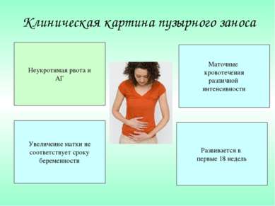 Клиническая картина пузырного заноса Неукротимая рвота и АГ Увеличение матки ...