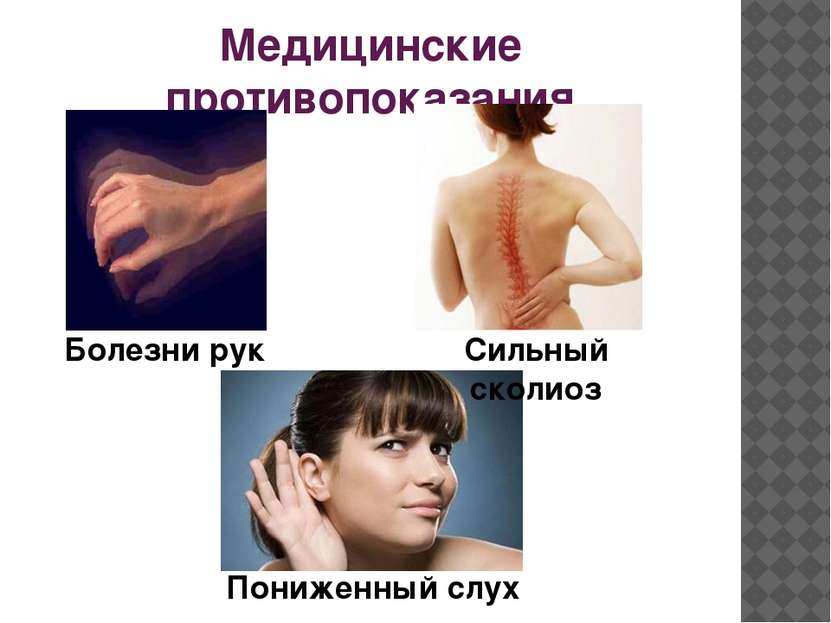 Медицинские противопоказания Болезни рук Сильный сколиоз Пониженный слух