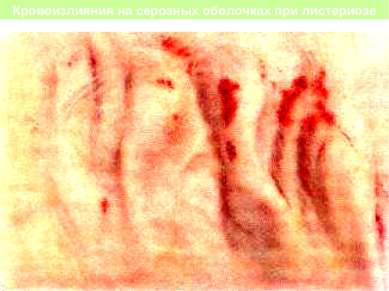 Кровоизлияния на серозных оболочках при листериозе