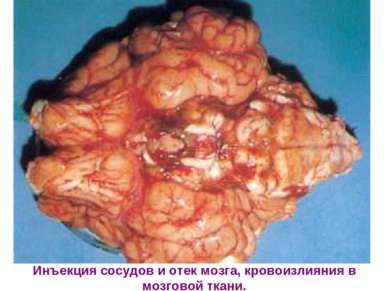 Инъекция сосудов и отек мозга, кровоизлияния в мозговой ткани.