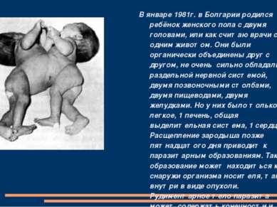 В январе 1981г. в Болгарии родился ребёнок женского пола с двумя головами, ил...