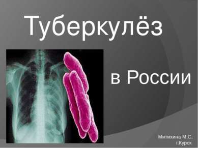 Туберкулёз Митихина М.С. г.Курск в России