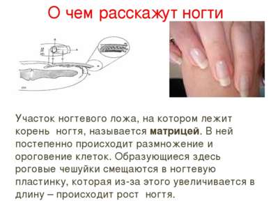 О чем расскажут ногти Участок ногтевого ложа, на котором лежит корень ногтя, ...