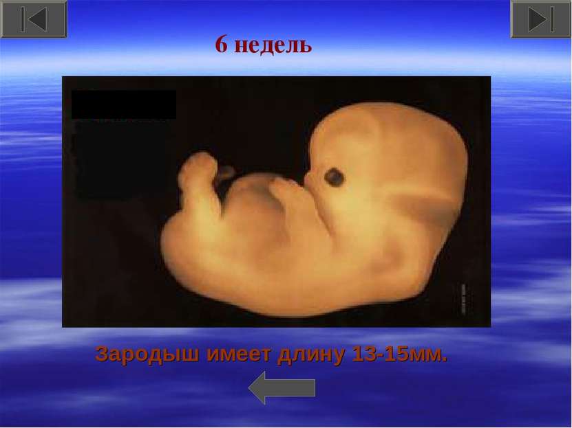 Зародыш имеет длину 13-15мм. 6 недель