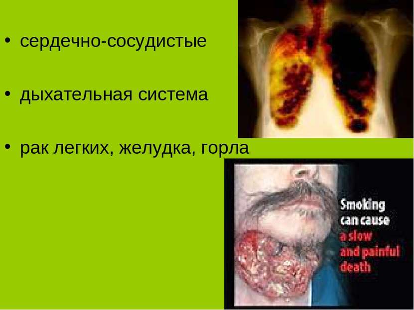 Заболевания курильщиков сердечно-сосудистые дыхательная система рак легких, ж...
