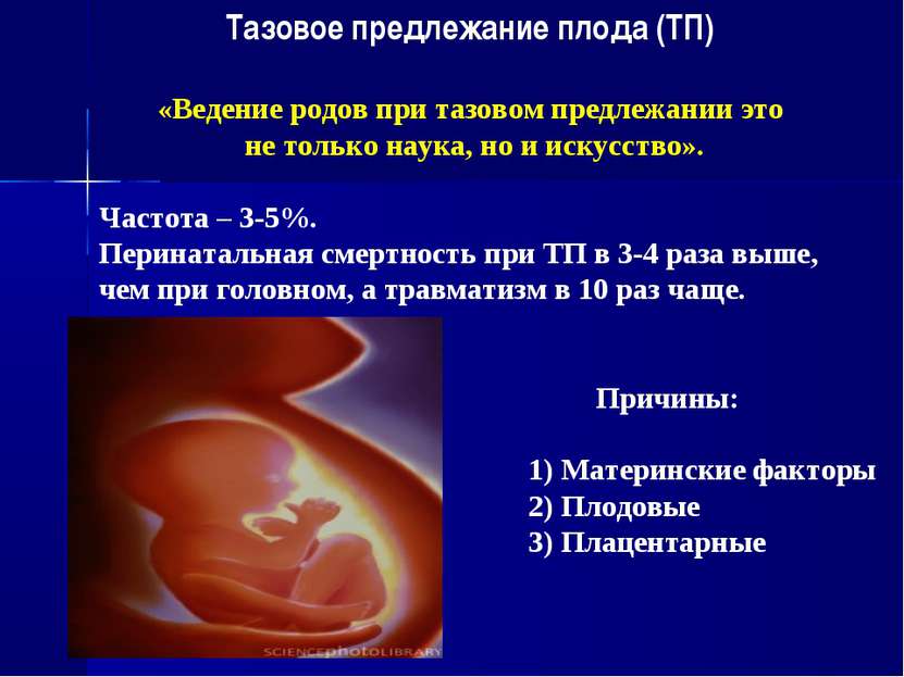 Тазовое предлежание плода (ТП) «Ведение родов при тазовом предлежании это не ...