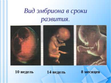 Вид эмбриона в сроки развития. 10 недель 14 недель 8 месяцев
