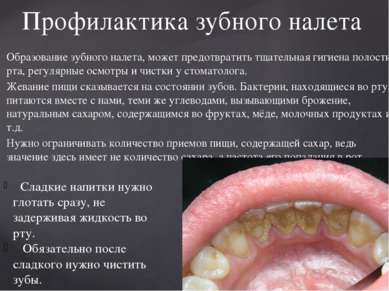 Образование зубного налета, может предотвратить тщательная гигиена полости рт...