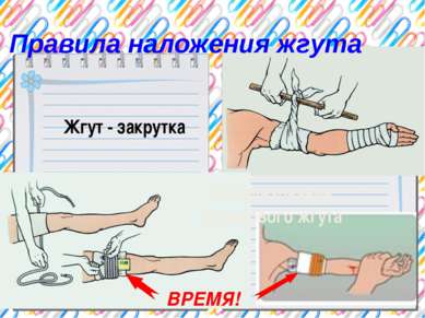 Правила наложения жгута Жгут - закрутка Использование резинового жгута ВРЕМЯ!