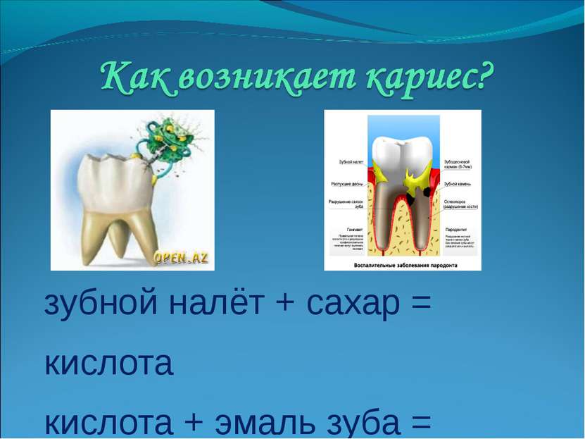зубной налёт + сахар = кислота кислота + эмаль зуба = кариес