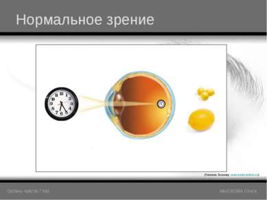 Нормальное зрение (Клиника Эксимер www.excimerclinic.ru) Органы чувств: Глаз ...