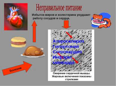 Избыток жиров и холестерина ухудшает работу сосудов и сердца. Атеросклероз Ги...